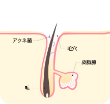 正常な肌